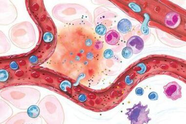 Účinok Boswellie na zapálené oblasti tela